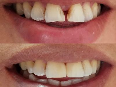 Dr Nair's Dental and Implant centre