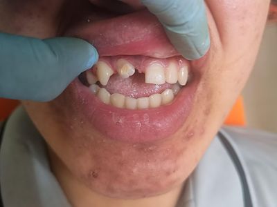 Dr. Preeti's smile up dental clinic| dentist| wagholi